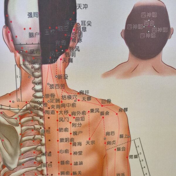 Affiches d'acupuncture sur rouleau de brocart